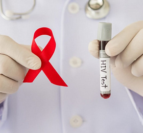В Сочи можно пройти тест на ВИЧ бесплатно и анонимно