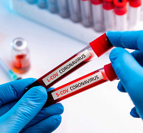 На Кубани коронавирус выявили у еще 521 человека